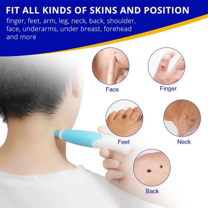 Double Headed Wart Removing Pen Set Auto Skin Tag Remover Painless Mole Wart Remover Skin Tag Removal Kit Skin Care Beauty Tool